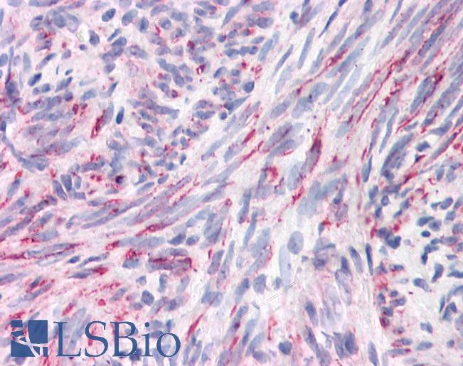 Anti-ANAPC4 / APC4 antibody IHC of human uterus. Immunohistochemistry of formalin-fixed, paraffin-embedded tissue after heat-induced antigen retrieval. Antibody LS-B4643 concentration 5 ug/ml.