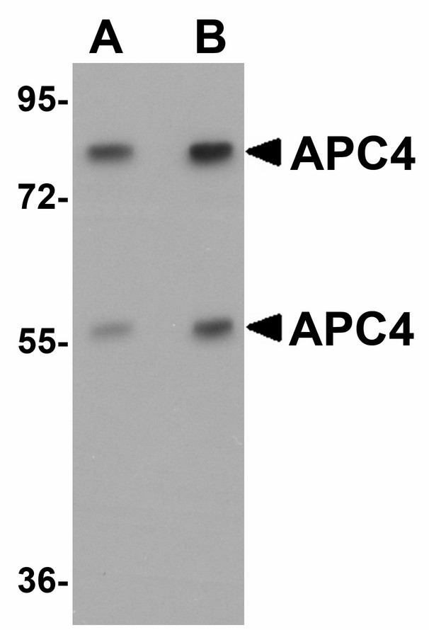 Western blot of APC4 in mouse liver tissue lysate with APC4 antibody at (A) 1 and (B) 2 ug/ml.