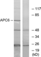 Western blot of extracts from NIH-3T3 cells, using APC6 Antibody. The lane on the right is treated with the synthesized peptide.