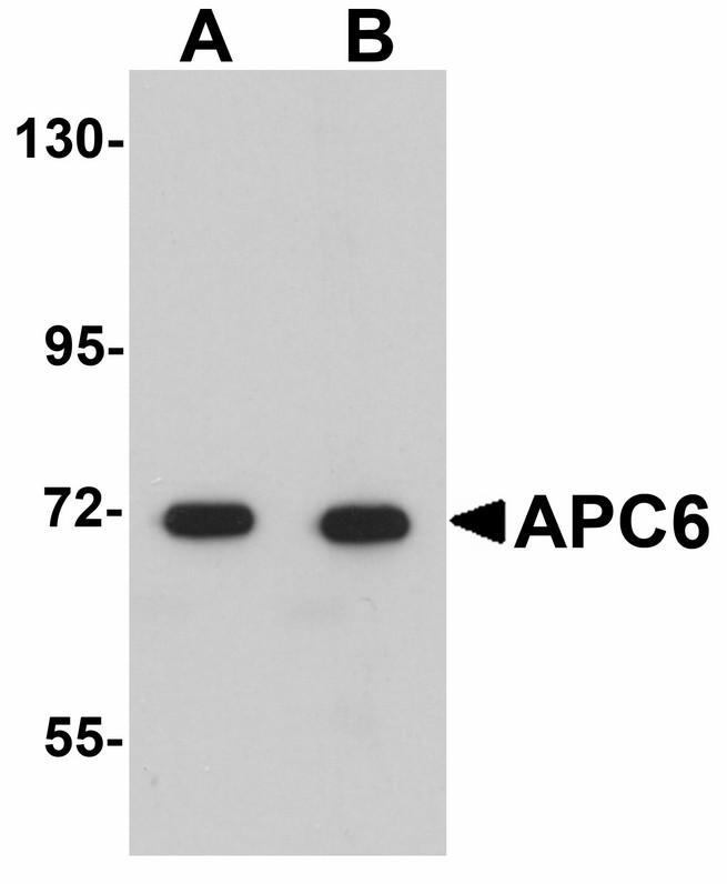 Western blot of APC6 in human liver tissue lysate with APC6 antibody at (A) 1 and (B) 2 ug/ml.