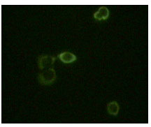 Immunofluorescence staining of methanol-fixed HeLa cells using ABL2 mouse monoclonal antibody showing cytoplasm localization.