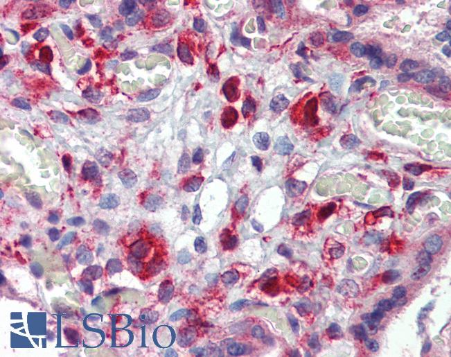 Anti-AAK1 antibody IHC of human placenta. Immunohistochemistry of formalin-fixed, paraffin-embedded tissue after heat-induced antigen retrieval. Antibody LS-B3843 concentration 5 ug/ml.