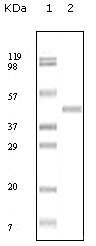 Western blot using ABL2 mouse monoclonal antibody against truncated ABL2 recombinant protein.