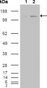 Western blot using ABL2 mouse monoclonal antibody against HEK293T cells transfected with the pCMV6-ENTRY control (1) and pCMV6-ENTRY ABL2 cDNA (2).