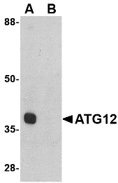 Western blot of ATG12 in mouse heart tissue lysate with ATG12 antibody at 1 ug/ml in (A) the absence and (B) the presence of blocking peptide.