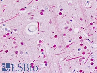 Human Brain: Formalin-Fixed, Paraffin-Embedded (FFPE)