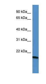 ATG12 antibody LS-B5897 Western blot of Rat Kidney lysate.