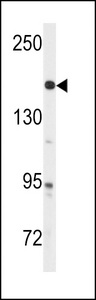 Western blot of anti-ABL Antibody (Y251) in A2058 cell line lysates (35 ug/lane). ABL(arrow) was detected using the purified antibody.