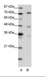 A: Marker, B: Rap Cell Lysate