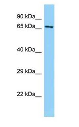 ABLIM1 antibody Western Blot of Mouse Heart.