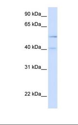 Placenta lysate. Antibody concentration: 1.0 ug/ml. Gel concentration: 12%.