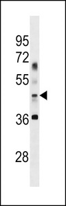 APG4B Antibody (Center G254)western blot of Uterus tissue lysates (35 ug/lane). The APG4B antibody detected the APG4B protein (arrow).