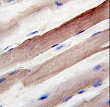 Formalin-fixed and paraffin-embedded human skeletal muscle reacted with Autophagy APG4B Antibody (E273), which was peroxidase-conjugated to the secondary antibody, followed by DAB staining. This data demonstrates the use of this antibody for immunohistochemistry; clinical relevance has not been evaluated.