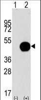 Western blot of APG4B (arrow) using purified antibody. 293 cell lysates (2 ug/lane) either nontransfected (Lane 1) or transiently transfected with the APG4B gene (Lane 2) (Origene Technologies).