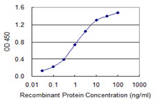 Detection limit for recombinant GST tagged ABLIM1 is 0.03 ng/ml as a capture antibody.