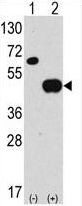 Western blot of anti-hAPG4B-R31 antibody in 293 cell line lysates transiently transfected with the ATG4B gene (2 ug/lane). hAPG4B-R31(arrow) was detected using the purified antibody.