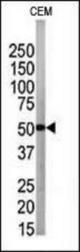 The anti-APG4B antibody is used in Western blot to detect APG4B in CEM tissue lysate