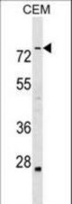 ABLIM3 Antibody western blot of CEM cell line lysates (35 ug/lane). The ABLIM3 antibody detected the ABLIM3 protein (arrow).