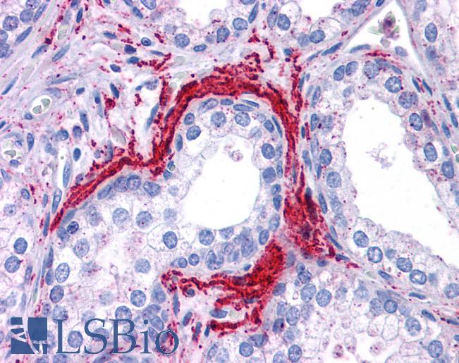 Anti-ATG5 antibody IHC of human prostate. Immunohistochemistry of formalin-fixed, paraffin-embedded tissue after heat-induced antigen retrieval. Antibody LS-B4678 concentration 5 ug/ml.