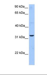 HepG2 cell lysate. Antibody concentration: 1.0 ug/ml. Gel concentration: 12%.