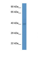 ABO antibody LS-C135229 Western blot of Mouse Spleen lysate. Antibody concentration 1 ug/ml.