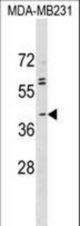 ABO Antibody western blot of MDA-MB231 cell line lysates (35 ug/lane). The ABO antibody detected the ABO protein (arrow).