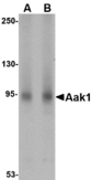 Western blot of Aak1 in A-20 lysate with Aak1 antibody at (A) 1 and (B) 2 ug/ml.