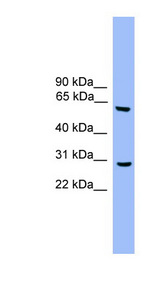 ATG5 antibody LS-C117039 Western blot of Fetal Heart lysate.