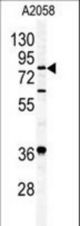 Western blot of APEH antibody in A2058 cell line lysates (35 ug/lane). APEH (arrow) was detected using the purified antibody.
