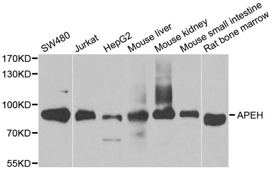 Western blot analysis of extracts of various cell lines, using APEH antibody.