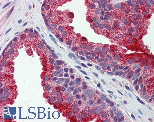 Anti-APEH antibody IHC of human prostate. Immunohistochemistry of formalin-fixed, paraffin-embedded tissue after heat-induced antigen retrieval. Antibody LS-B5812 concentration 5 ug/ml.