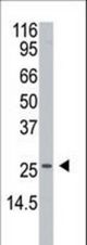 Western blot of anti-APH1 Antibody in A2058 cell line lysates (35 ug/lane). APH1 (arrow) was detected using the purified antibody.