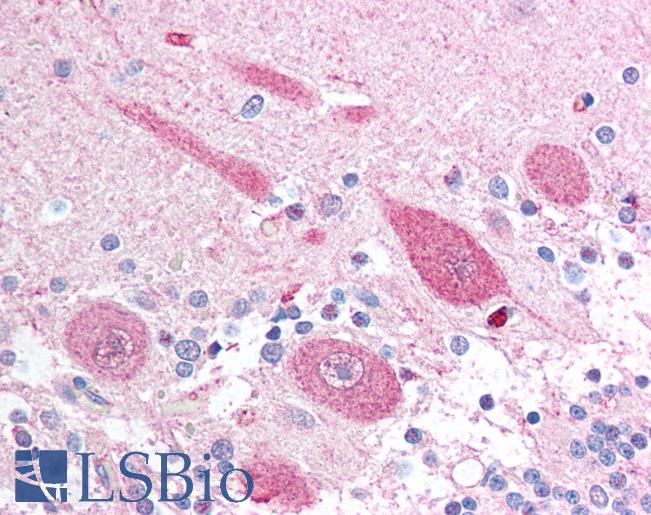 Anti-APH1A antibody IHC of human brain, cerebellum. Immunohistochemistry of formalin-fixed, paraffin-embedded tissue after heat-induced antigen retrieval. Antibody LS-B1328 concentration 5 ug/ml.