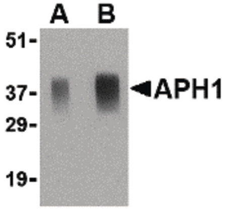 Western blot of APH1 in human brain tissue lysate with APH1 antibody at (A) 0.5 and (B) 1 ug/ml.