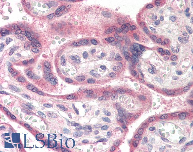 Anti-APH1A antibody IHC of human placenta. Immunohistochemistry of formalin-fixed, paraffin-embedded tissue after heat-induced antigen retrieval. Antibody LS-B443 concentration 5 ug/ml.