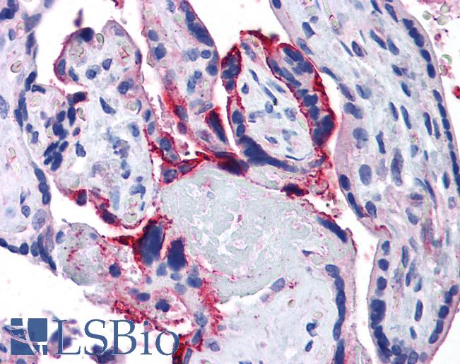 Anti-APH1A antibody IHC of human placenta. Immunohistochemistry of formalin-fixed, paraffin-embedded tissue after heat-induced antigen retrieval. Antibody LS-B4350 concentration 5 ug/ml.
