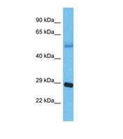 Western blot of Human Lung Tumor. APH1B antibody dilution 1.0 ug/ml.