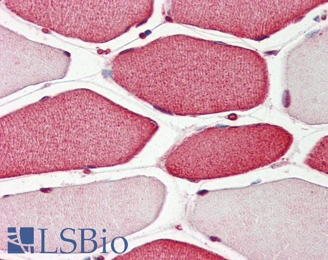 Anti-APIP antibody IHC staining of human skeletal muscle. Immunohistochemistry of formalin-fixed, paraffin-embedded tissue after heat-induced antigen retrieval.