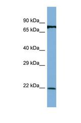 Western blot of Human MCF7. APIP antibody dilution 1.0 ug/ml.