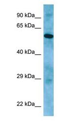 APLF / PALF antibody Western Blot of PANC1.