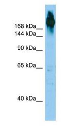 ABP-280 / FLNC antibody Western Blot of HepG2.