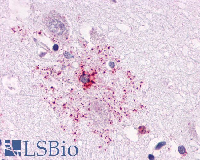 Anti-Apelin Receptor antibody LS-A63 IHC of human brain, astrocyte. Immunohistochemistry of formalin-fixed, paraffin-embedded tissue after heat-induced antigen retrieval.