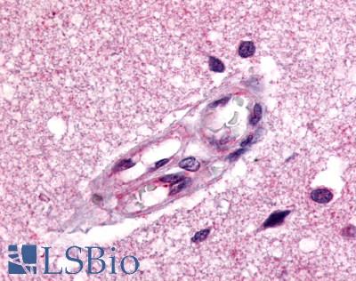 Anti-Apelin Receptor antibody LS-A65 IHC of human brain, vessels. Immunohistochemistry of formalin-fixed, paraffin-embedded tissue after heat-induced antigen retrieval.