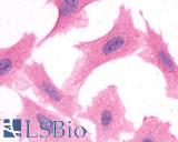 Anti-Apelin Receptor antibody LS-A65 immunocytochemistry (ICC) staining of HEK293 human embryonic kidney cells transfected with Apelin Receptor.