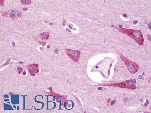 Human Brain, Cortex: Formalin-Fixed, Paraffin-Embedded (FFPE)
