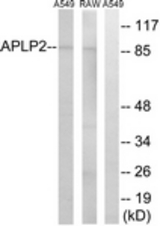 Western blot of extracts from RAW264.7/A549 cells, using APLP2 Antibody. The lane on the right is treated with the synthesized peptide.