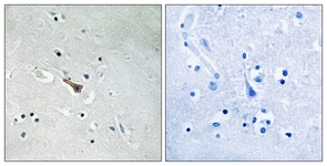 IHC of paraffin-embedded human brain, using APLP2 (Phospho-Tyr755) Antibody. The sample on the right was incubated with synthetic peptide.