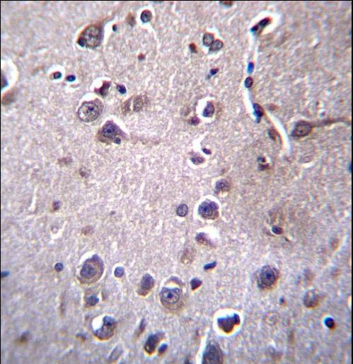 ITM2B Antibody immunohistochemistry of formalin-fixed and paraffin-embedded human brain tissue followed by peroxidase-conjugated secondary antibody and DAB staining.