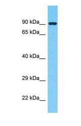 Western blot of APLP2 Antibody with human ACHN Whole Cell lysate.