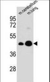 ITM2B Antibody western blot of mouse cerebellum,lung tissue lysates (35 ug/lane). The ITM2B antibody detected the ITM2B protein (arrow).